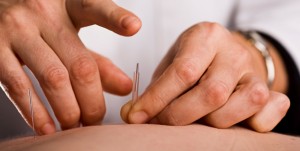 heal naturally-with acupuncture-image
