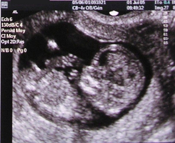 3,300 abortion deaths take place daily in America, so why does media focus on a handful of mass shooting deaths?